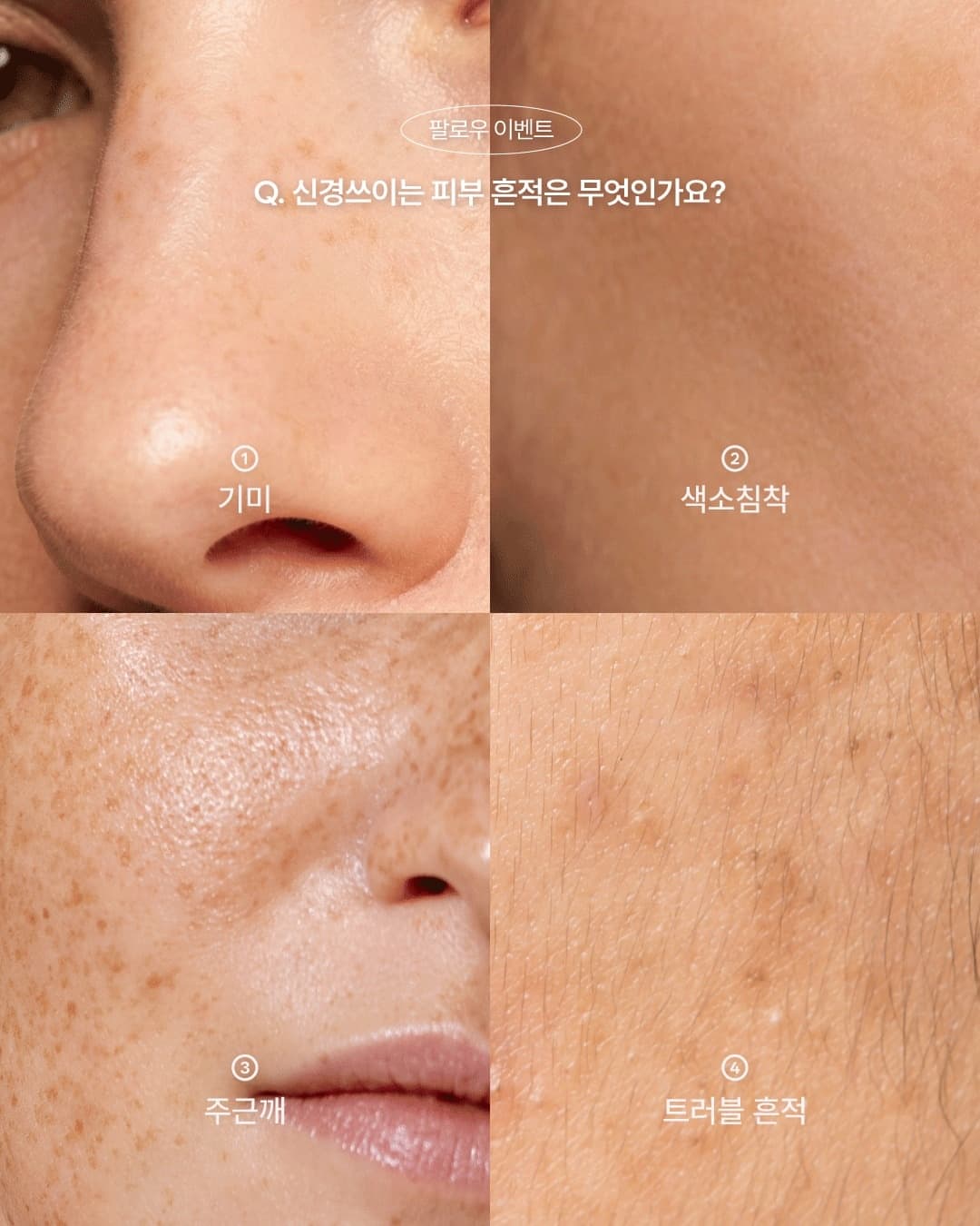 질문형 광고 소재 예시 — 4분할 선택지